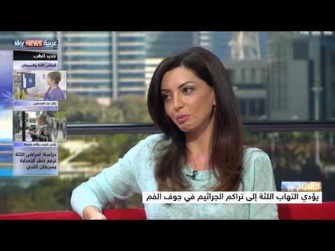 بالفيديو دراسة تربط بين أمراض اللثة عند السيدات وسرطان الثدي