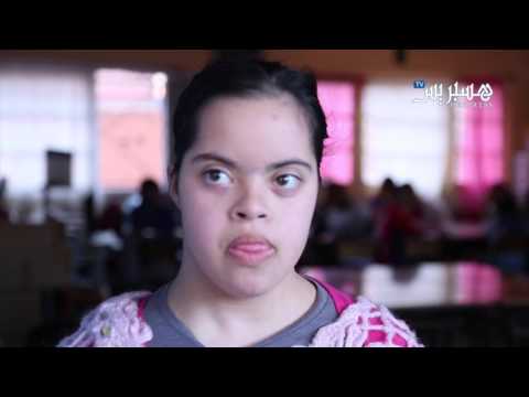 شاهد الحلقة 3 حقوق المعاقين