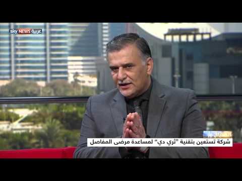 شاهد تقنية ثري دي لمساعدة مرضى المفاصل