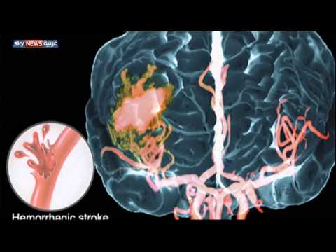شاهد ابتكارات طبية متنوعة ولافتة