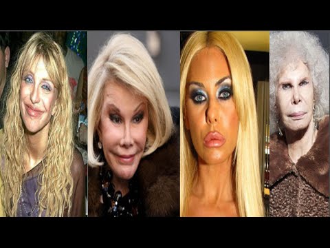 حالات صادمة لأسوأ عمليات التجميل بين المشاهير