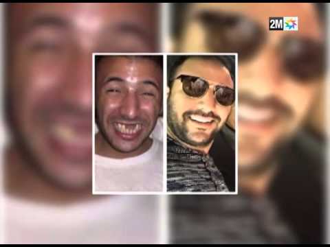 شاهدتكلفة عملية تجميل أسنان إيكو