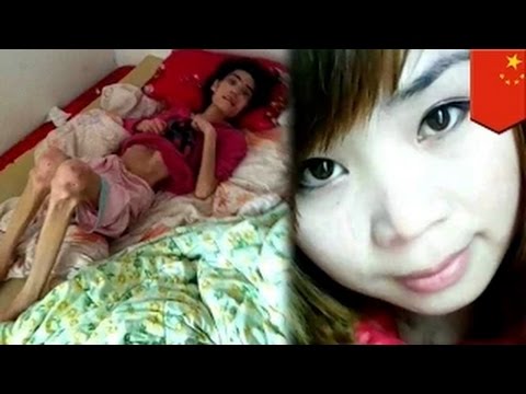 شاهد امرأة تقطع أذن كلب بأسنانها