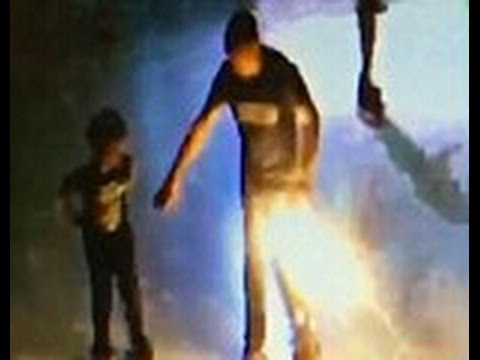 شاهد انفجار سيجارة إلكترونية في جيب رجل