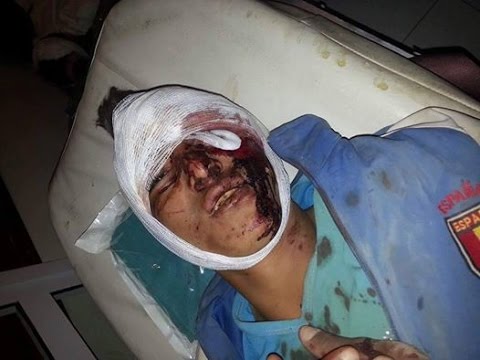 هكذا استقبل مستشفى مولاي علي الشريف في الرشيدية 47 تلميذًا جريحًا