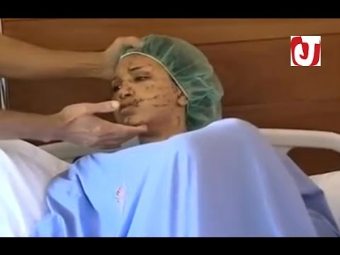 بالفيديو زوج يشوه وجه زوجته القاصر ويمزق جسدها بشفرة حلاقة