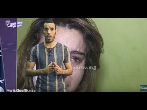 فيديو كلثوم فتاة بيضاوية ضحية ذئب بشري ضيع حياتها وشوه وجهها